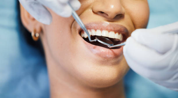Best Emergency Root Canal Treatment in Euharlee, GA