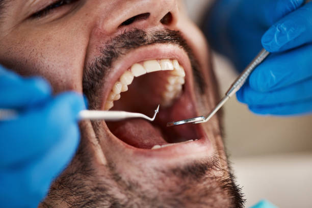 Best Same-Day Emergency Dentist in Euharlee, GA