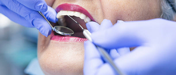 Best Emergency Broken Tooth Repair in Euharlee, GA
