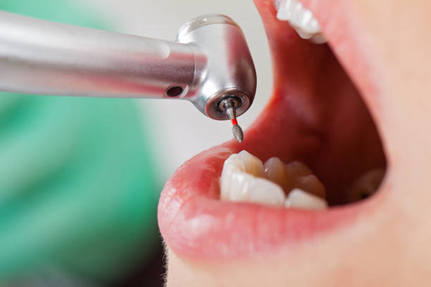 Best Pediatric Emergency Dentist in Euharlee, GA